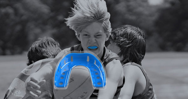 NeoMorph - Triple-Layered Mouthguard (For use with or without braces)